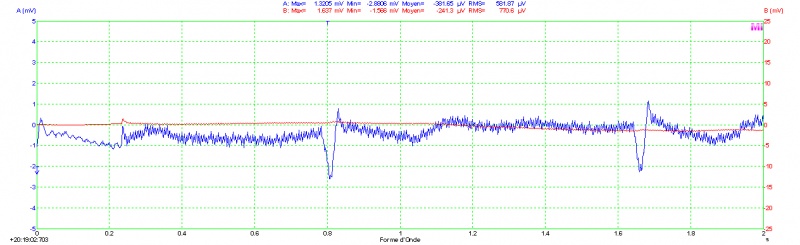Ecg-stabilized.jpg